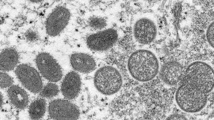 WHO considers declaring monkeypox a global health emergency