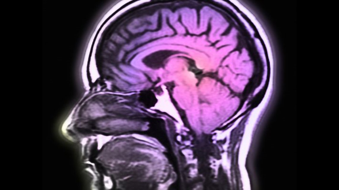 Zapping your brain for peak performance