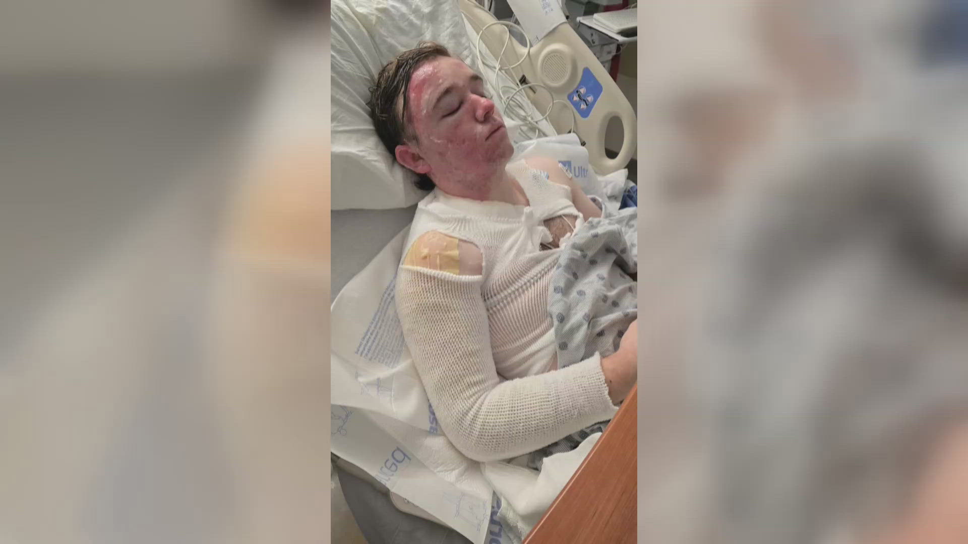 Co-worker throws hot oil on California McDonald's employee, 20