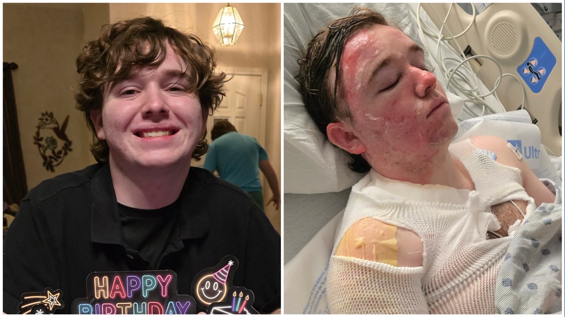 洋楽 Burned Co-worker throws hot oil on California McDonald's employee, 20