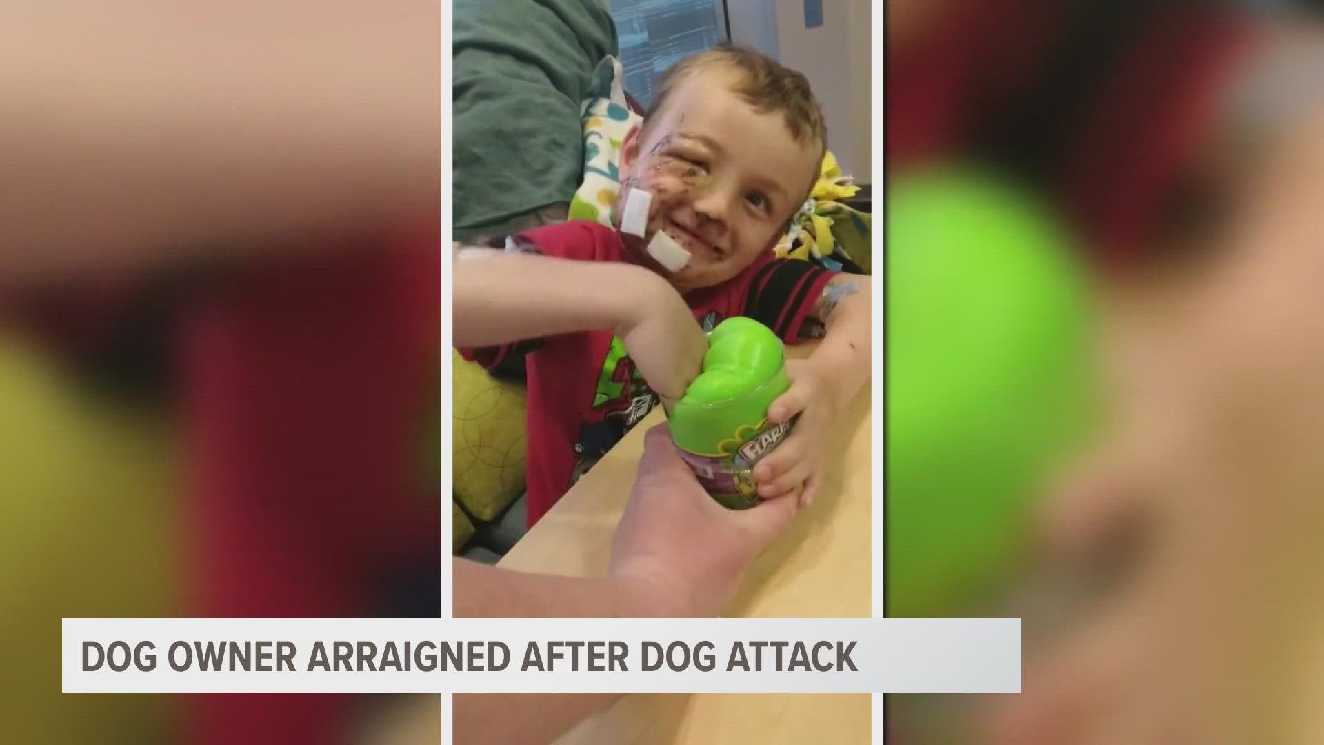A Montcalm County man is facing felony charges after police say his two dogs attacked and severely injured a five-year-old boy.