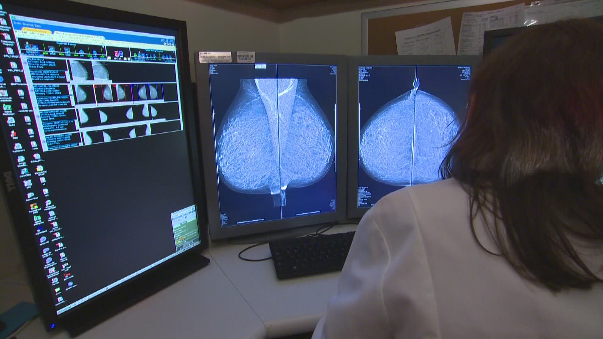 Dr. Laurie Birkholz suggests four small changes you can make to help prevent and detect breast cancer.