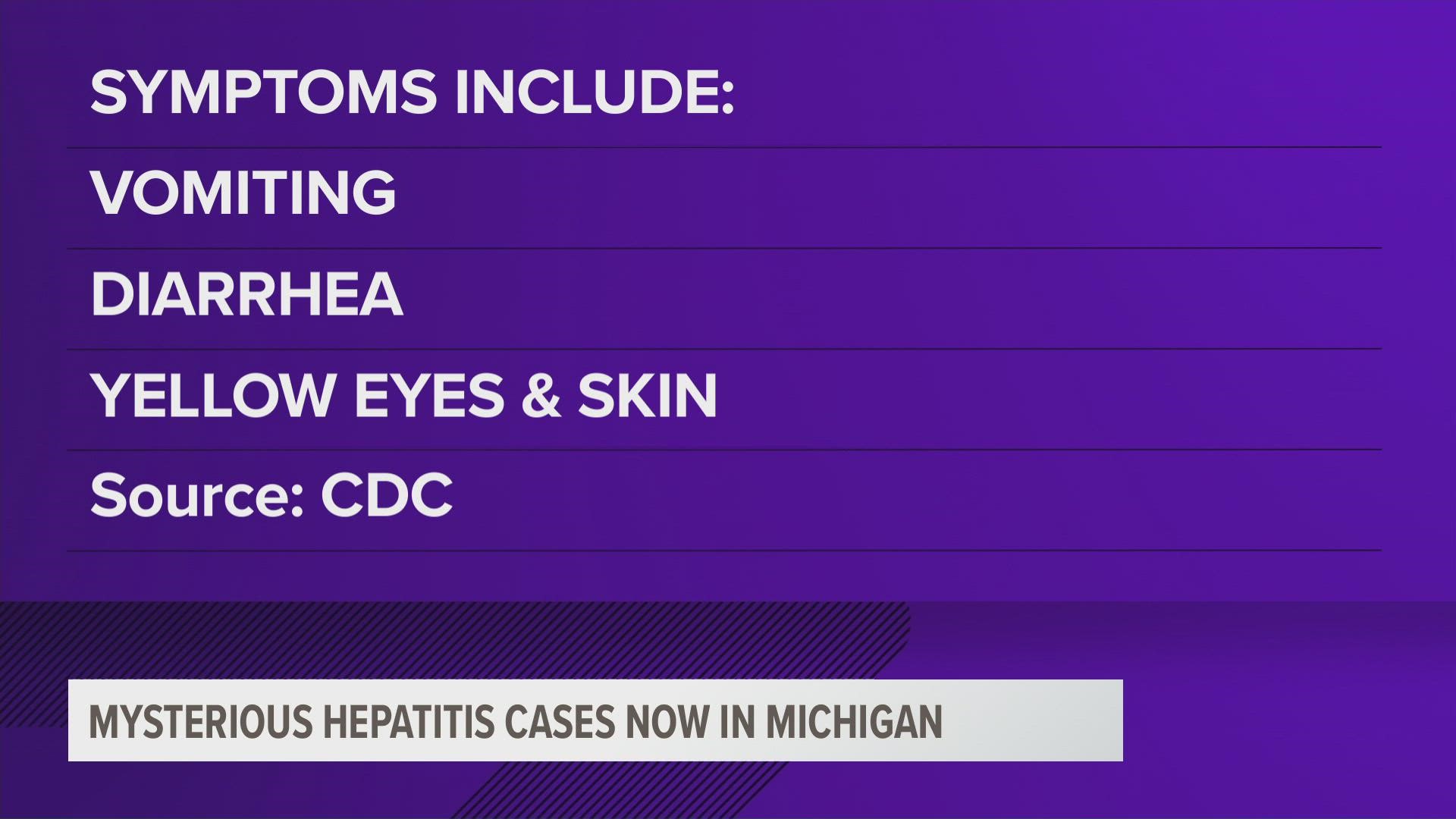 Two children on the east side of the state have what the CDC is calling mysterious hepatitis.