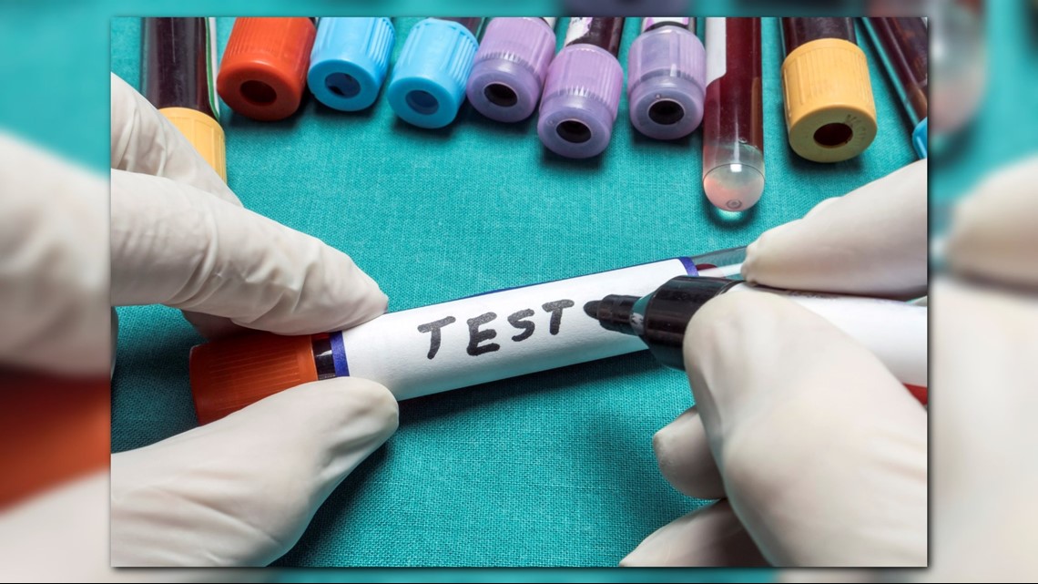 ADHD, violent crimes among the list of lifelong lead poisoning effects