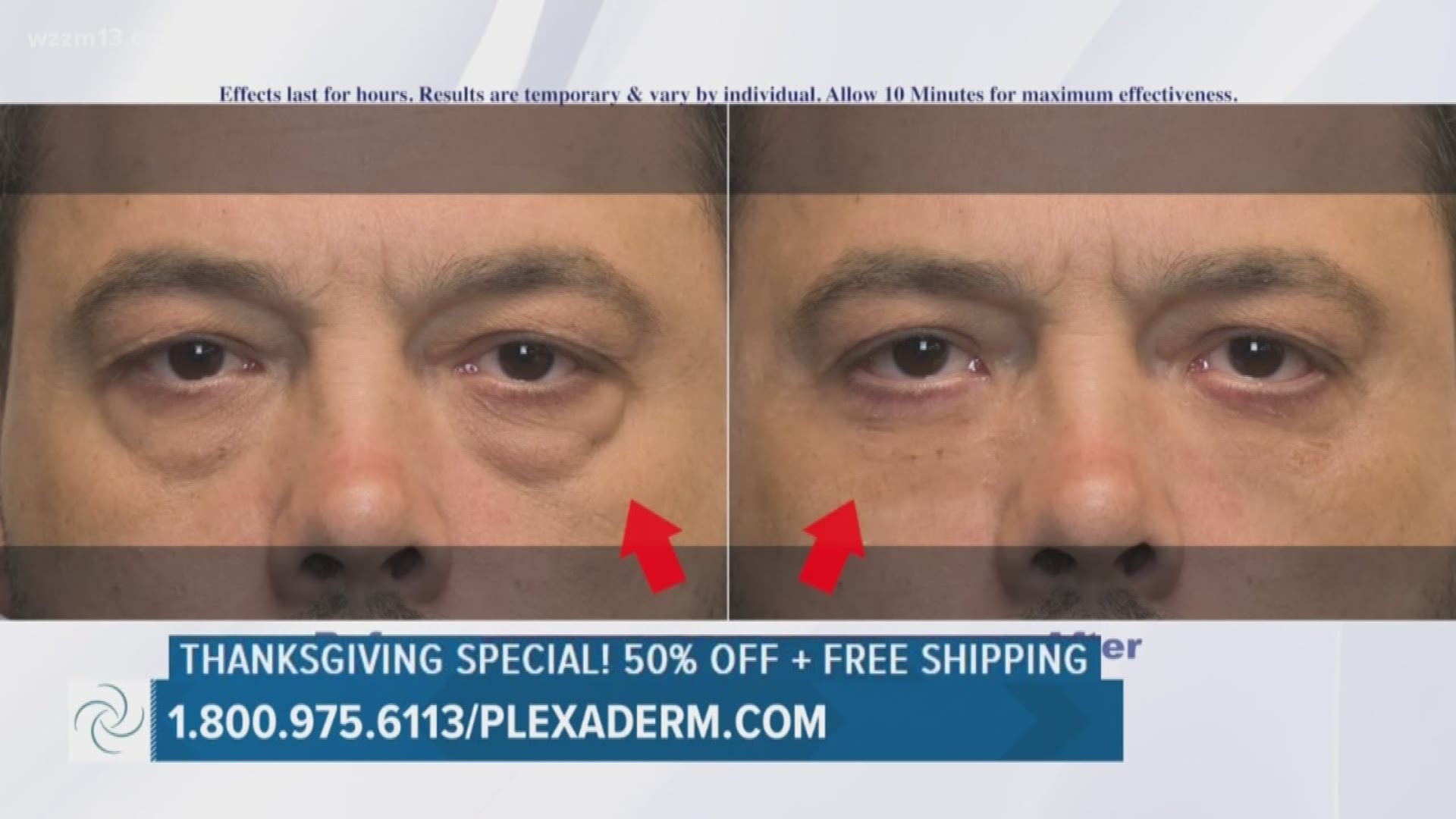 Reduce the signs of aging in just a few minutes with Plexaderm.