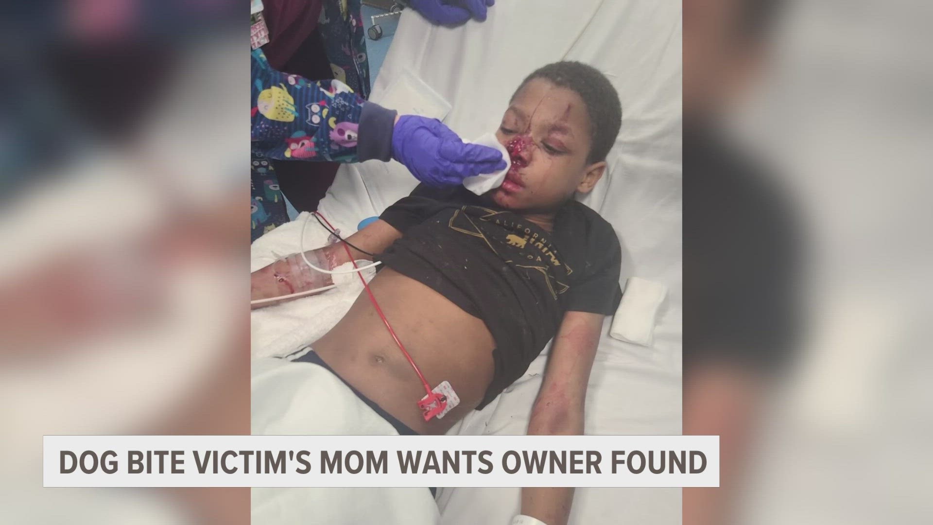 The family of a child who was attacked by a dog wants justice.