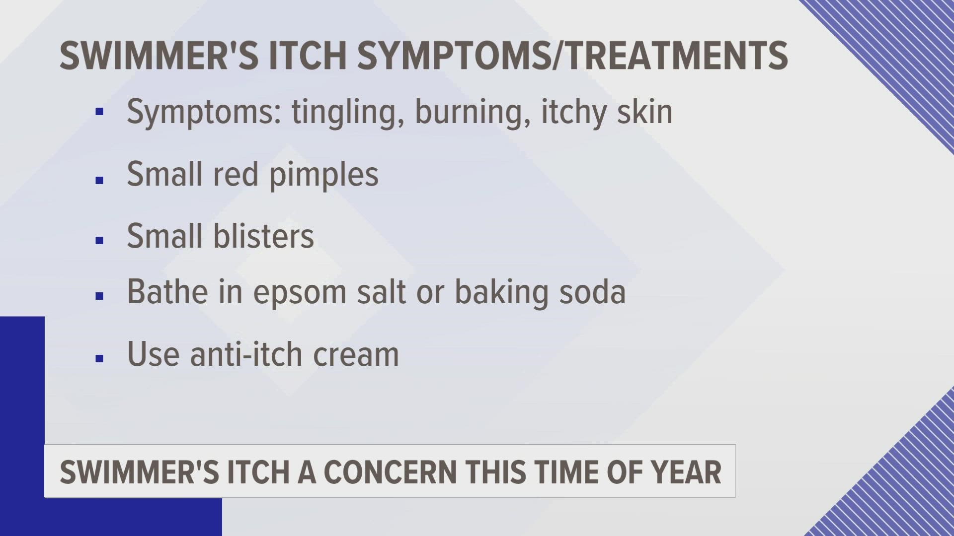 allergic reaction swimmers itch rash