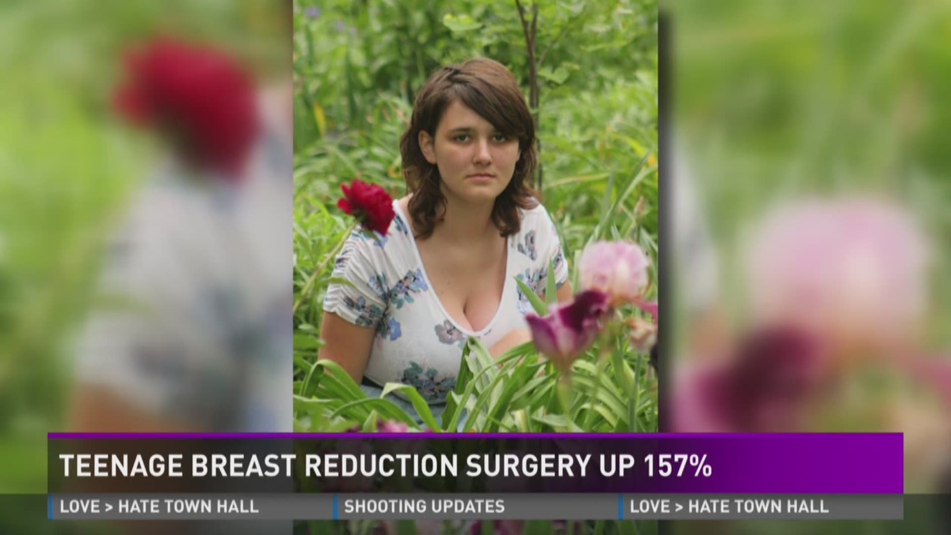 Medical student hated her 30J boobs so much she had breast reduction  surgery at just 15 years old