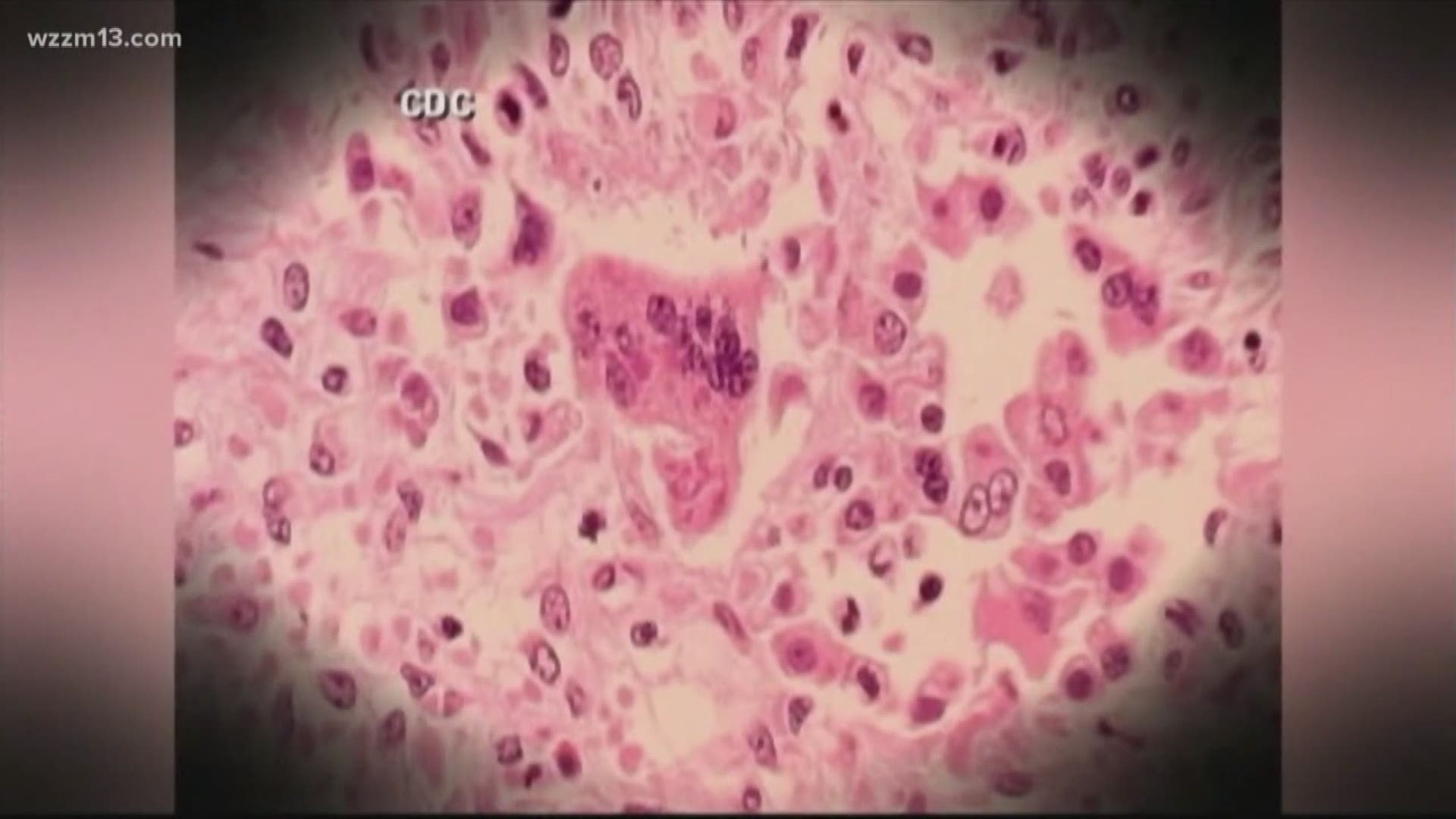 Officials urge vaccination after 15 Michigan measles cases