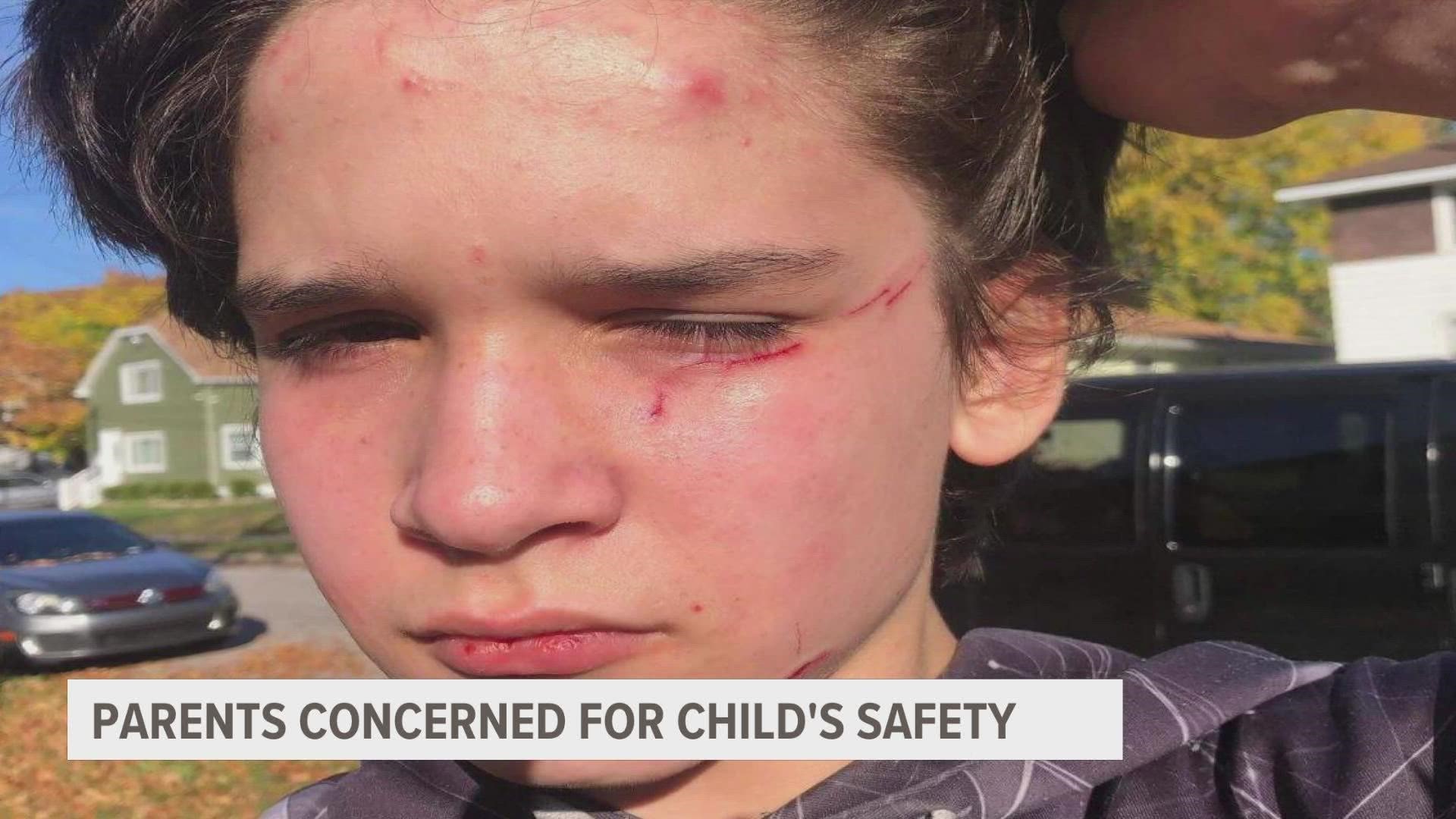 The parents say their son was cut in the face with a pair of scissors by two bullies after an altercation that started on the bus.