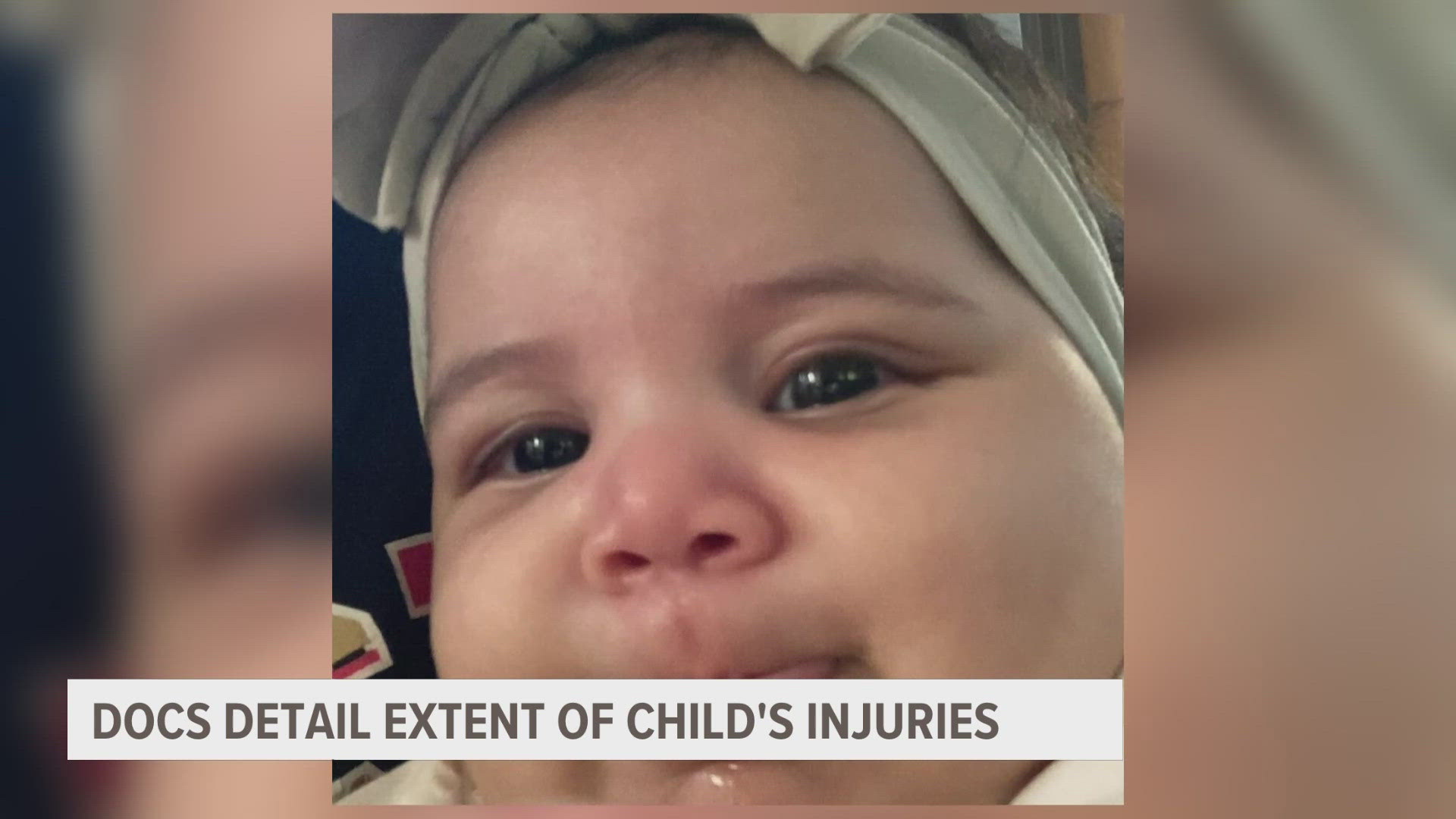 Renzi McCall was four and a half months old when her mother’s girlfriend allegedly beat her while under her care. New documents detail the extent of those injuries.