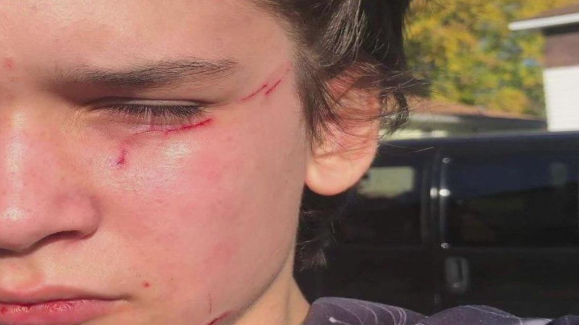 Parents speak on bullying concerns at Michigan school district - Vimarsana News