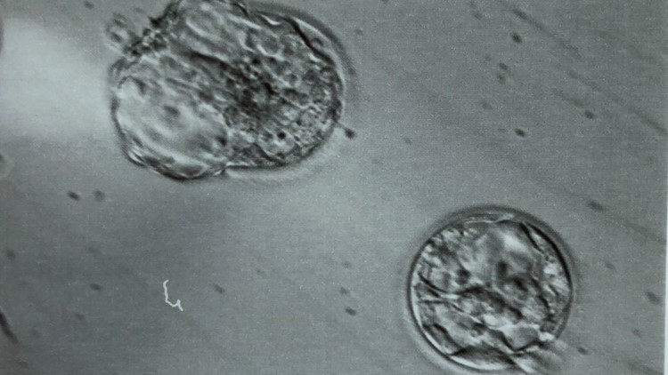 Thinking about adoption? Why not consider adopting frozen embryos