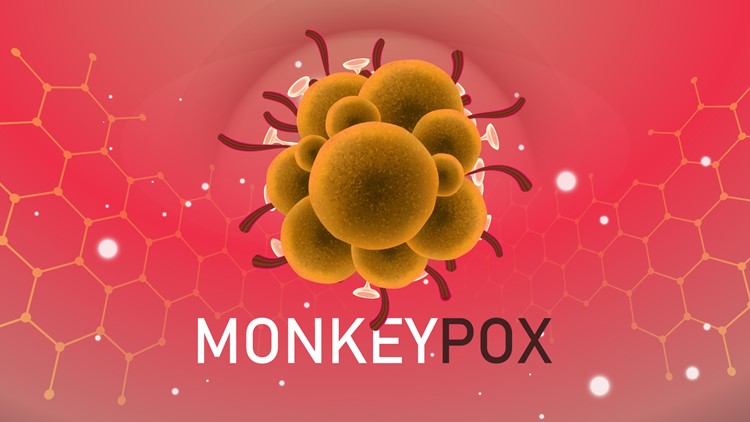 CDC says it's monitoring nearly 200 people in 27 states for Monkeypox