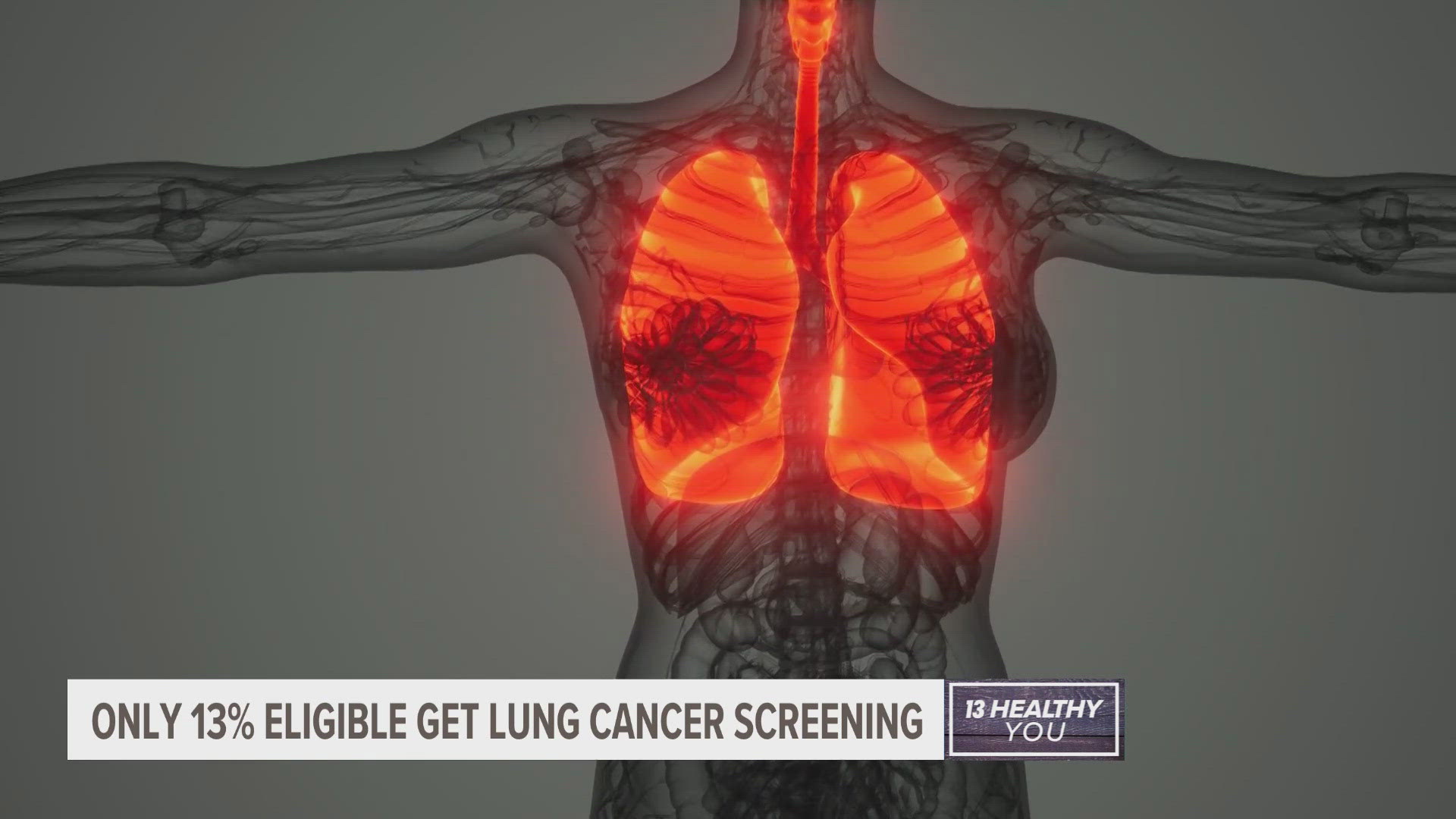 Lung cancer screening is a non-invasive CT scan. It can catch lung cancer early, before it becomes symptomatic and difficult to treat.