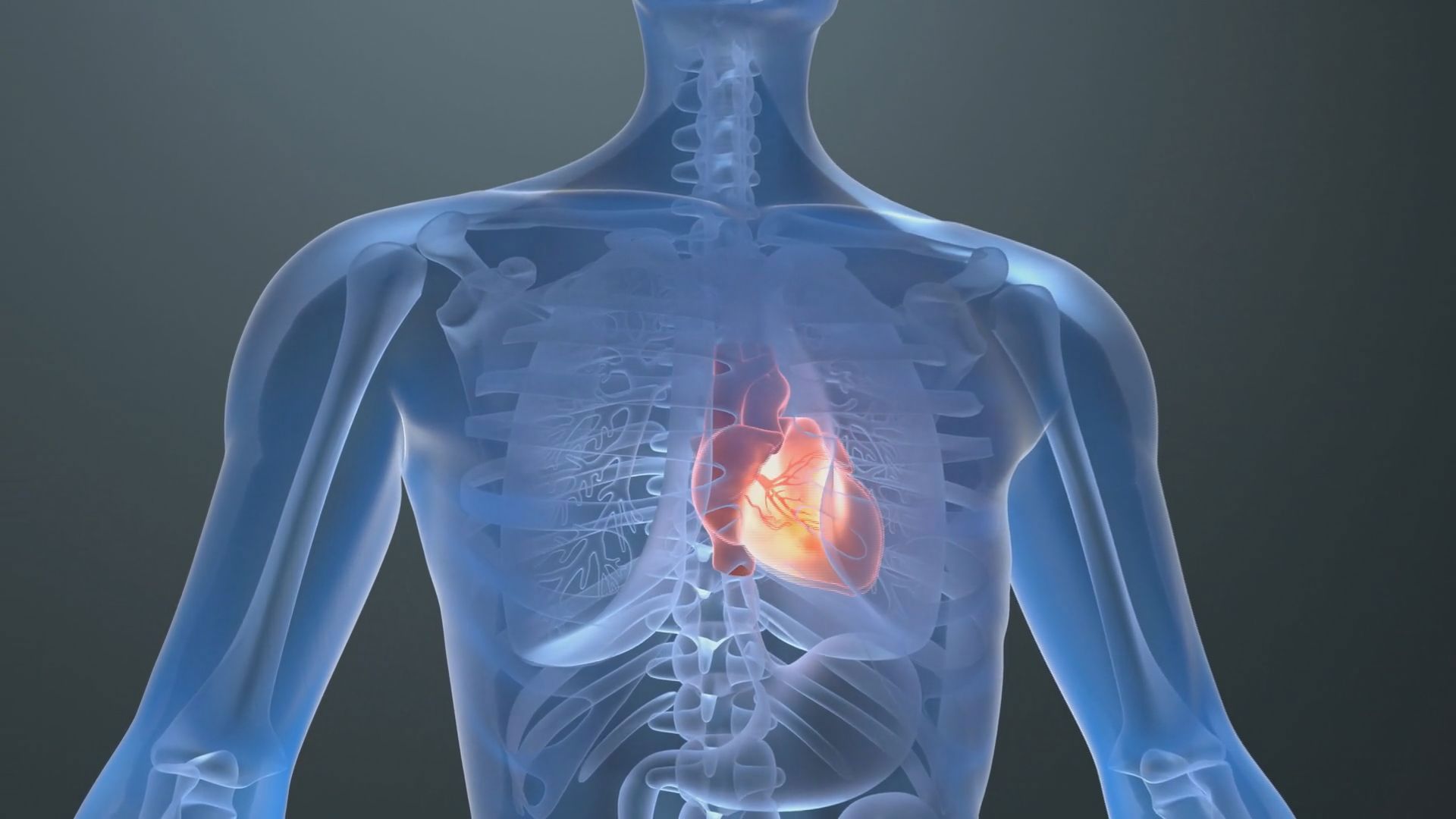 Here's what to know about arrhythmia