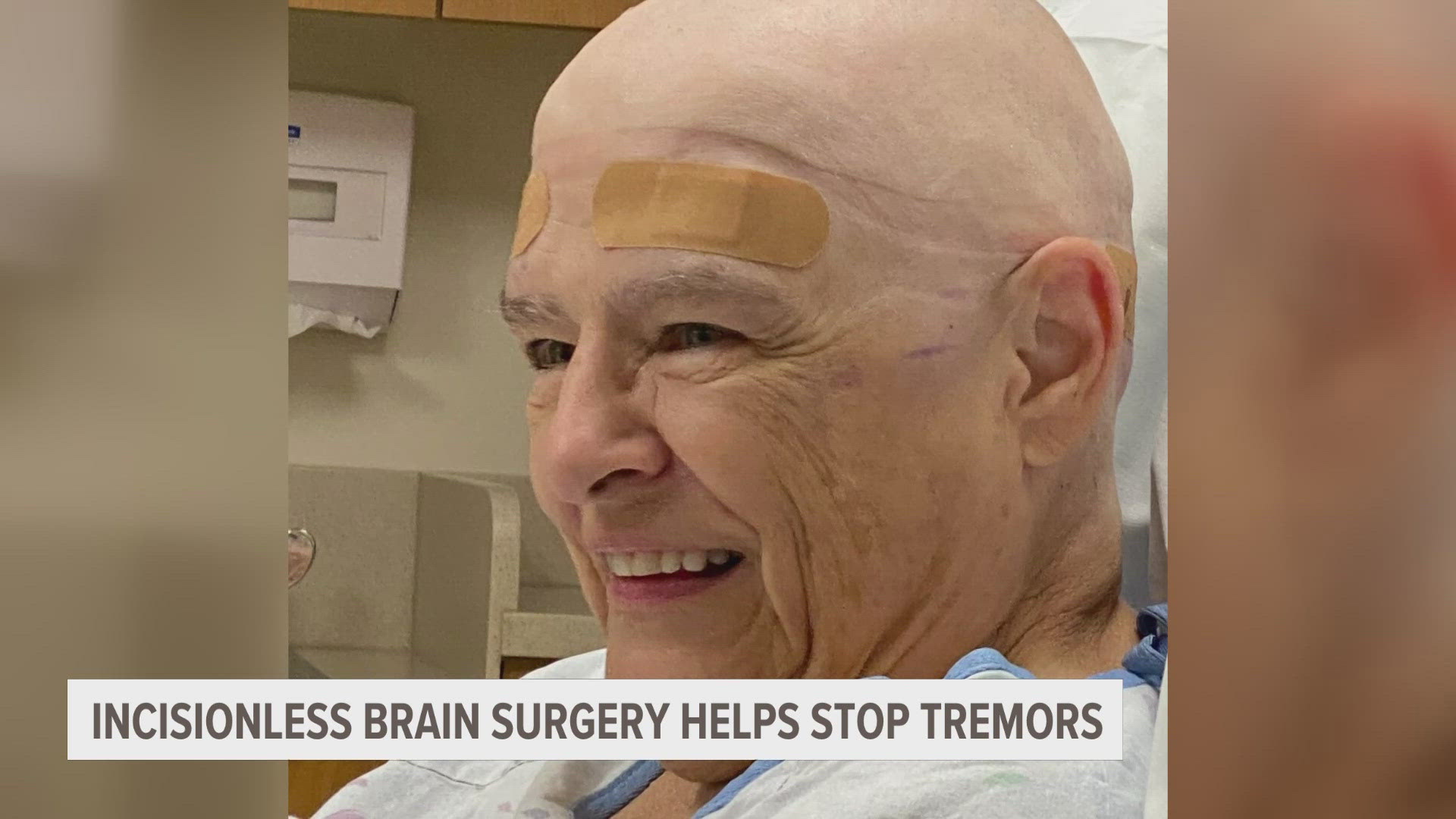 The new type of brain surgery uses ultrasound to heat up a portion of the brain. The procedure is designed to treat people with tremors.