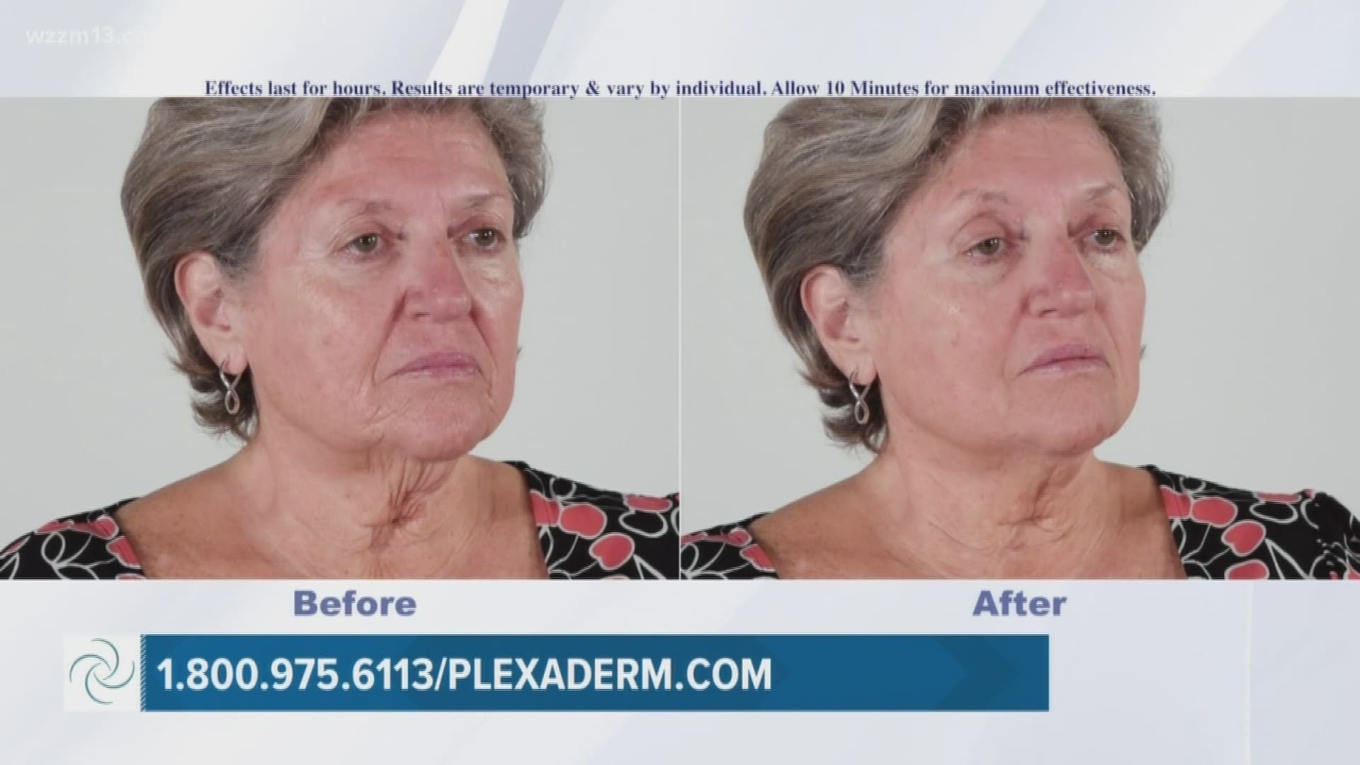 See how Plexaderm can help you look years younger.