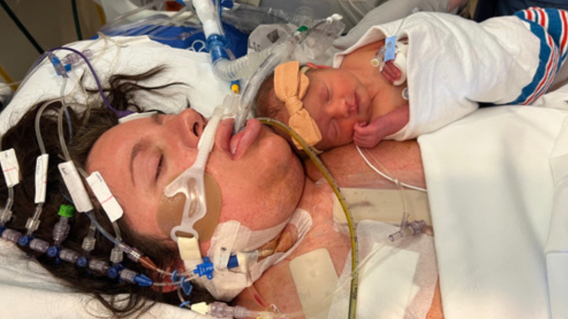 Michigan mom delivered her baby, survived open heart surgery - Vimarsana News