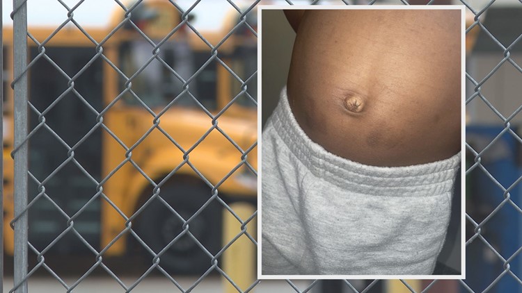 Parents looking for answers after 5-year-old son was injured while bullied on the school bus