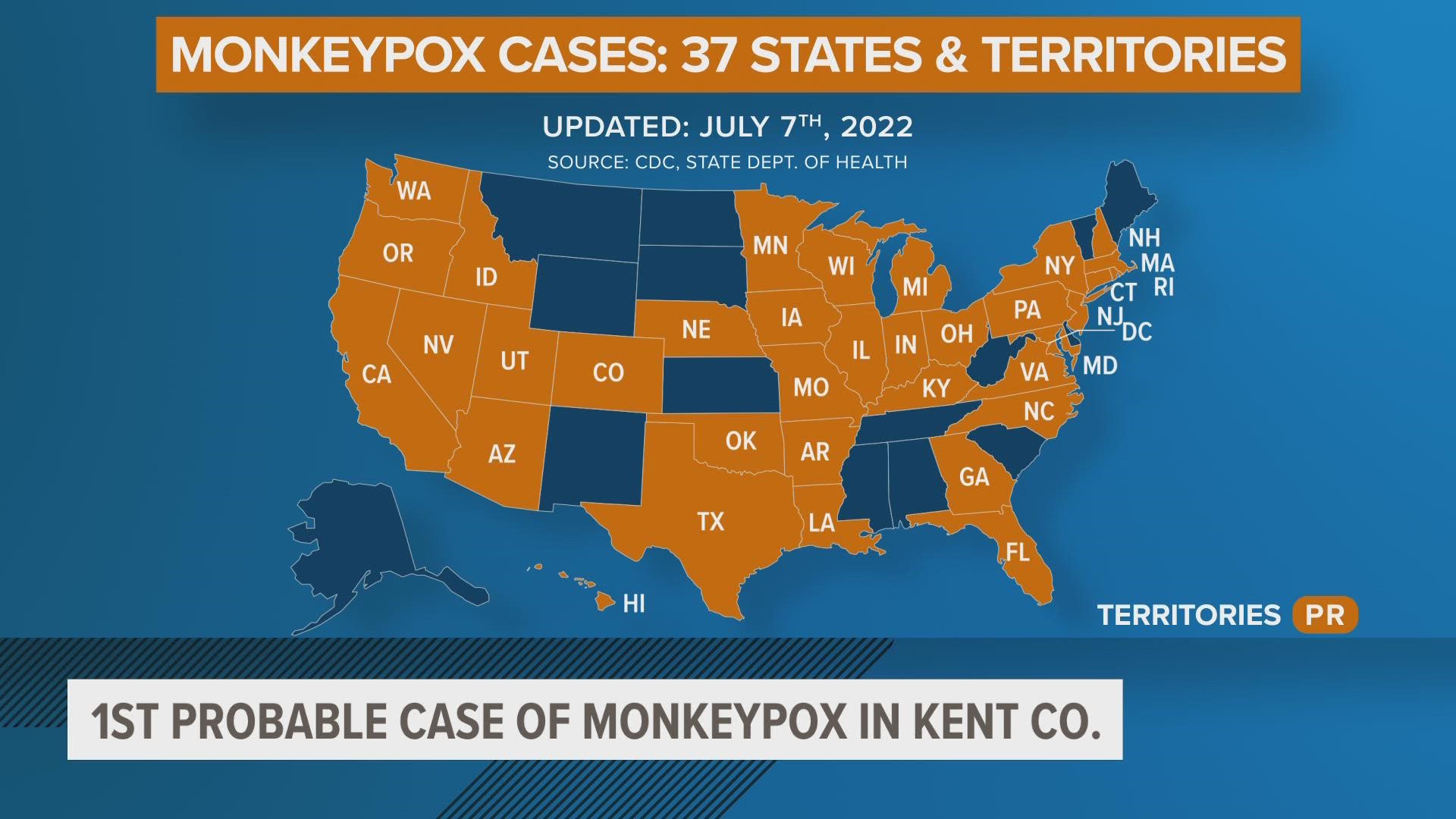 The first probably case of monkeypox was identified in Kent County, the Michigan Department of Health and Human Services discovered.